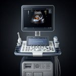 samsung hs50 ultrasound